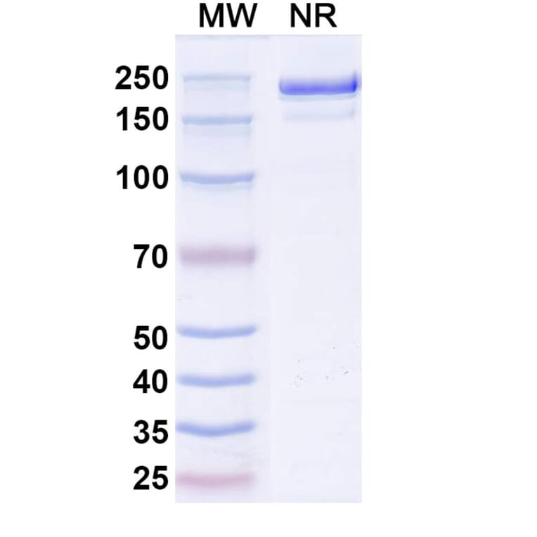 SDS-PAGE - Rezorstobart Biosimilar - Anti-CD161 Antibody - BSA and Azide free (A340612) - Antibodies.com