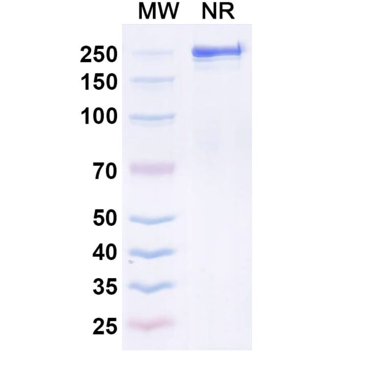 SDS-PAGE - Seniprutug Biosimilar - Anti-TRBV9 Antibody - BSA and Azide free (A340614) - Antibodies.com