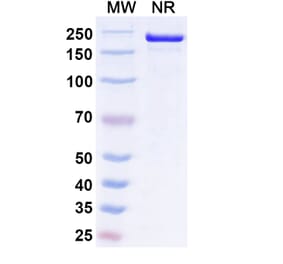 SDS-PAGE - Ucenprubart Biosimilar - Anti-CD200R Antibody - BSA and Azide free (A340620) - Antibodies.com