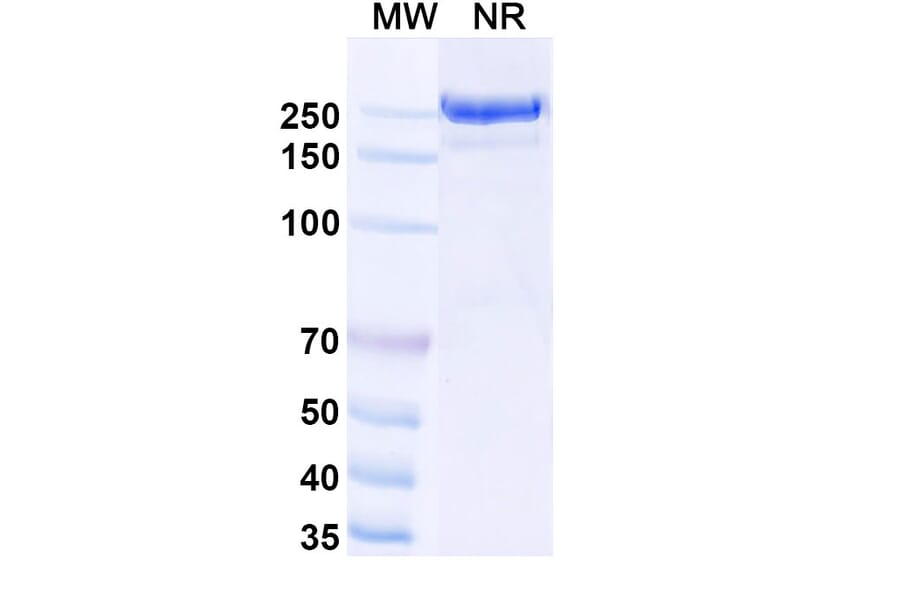 SDS-PAGE - Usilnetug Biosimilar - Anti-APP Antibody - BSA and Azide free (A340622) - Antibodies.com