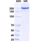 SDS-PAGE - Usilnetug Biosimilar - Anti-APP Antibody - BSA and Azide free (A340622) - Antibodies.com