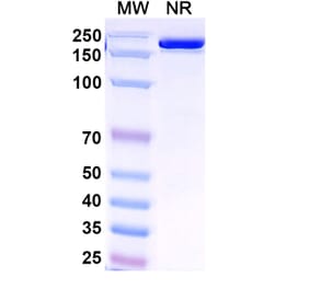 SDS-PAGE - Venanprubart Biosimilar - Anti-BTLA Antibody - BSA and Azide free (A340623) - Antibodies.com