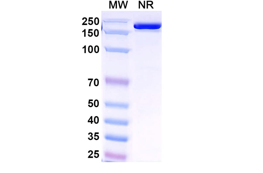 SDS-PAGE - Venanprubart Biosimilar - Anti-BTLA Antibody - BSA and Azide free (A340623) - Antibodies.com