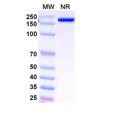 SDS-PAGE - Venanprubart Biosimilar - Anti-BTLA Antibody - BSA and Azide free (A340623) - Antibodies.com