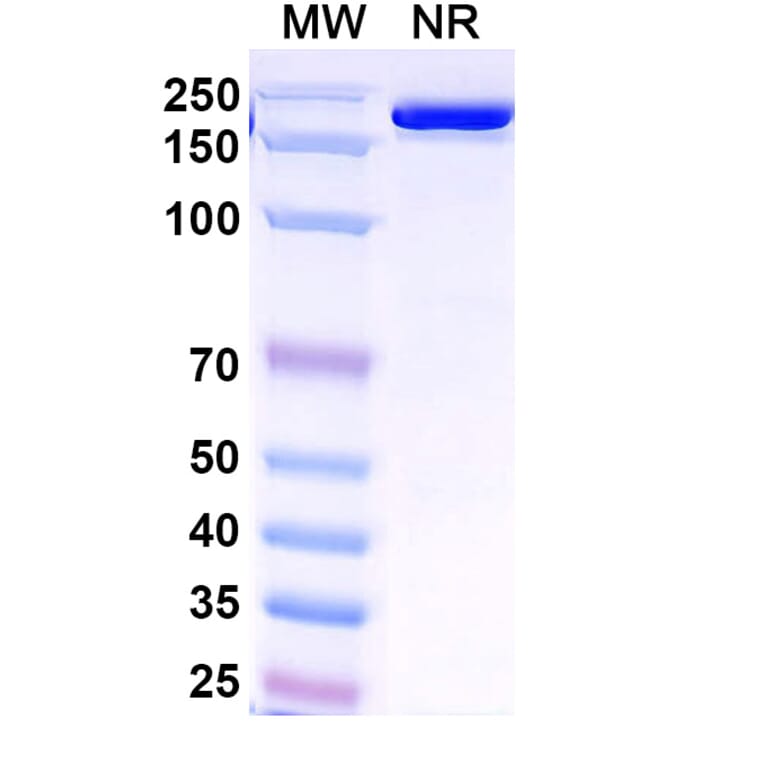 SDS-PAGE - Venanprubart Biosimilar - Anti-BTLA Antibody - BSA and Azide free (A340623) - Antibodies.com