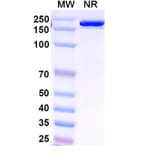 SDS-PAGE - Venanprubart Biosimilar - Anti-BTLA Antibody - BSA and Azide free (A340623) - Antibodies.com