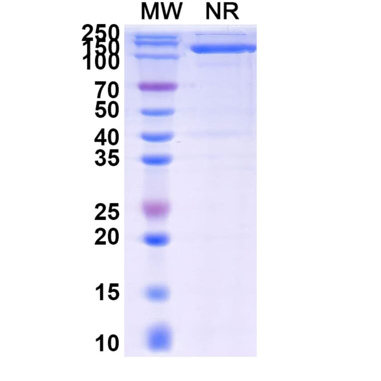 SDS-PAGE - Venanprubart Biosimilar - Anti-BTLA Antibody - BSA and Azide free (A340623) - Antibodies.com
