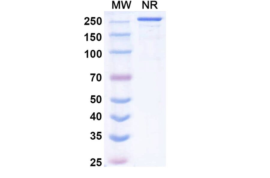 SDS-PAGE - Vilastobart Biosimilar - Anti-CTLA-4 Antibody - BSA and Azide free (A340625) - Antibodies.com