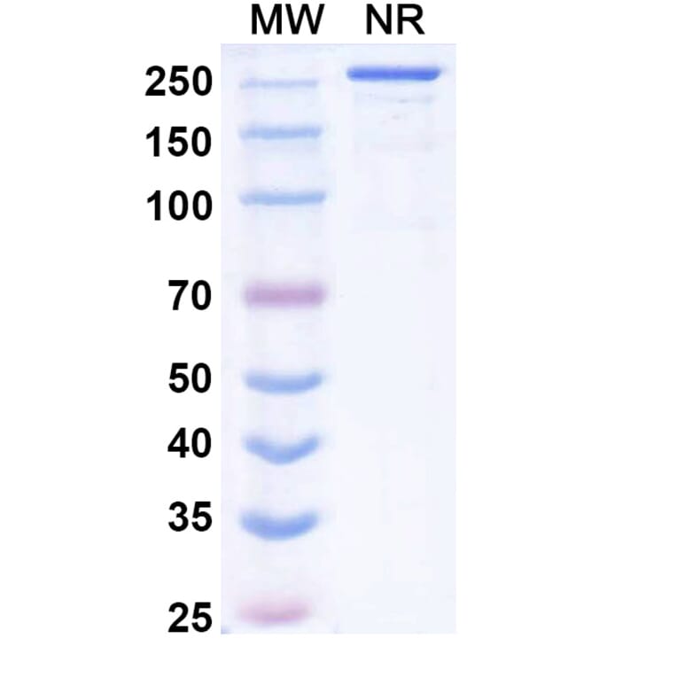 SDS-PAGE - Vilastobart Biosimilar - Anti-CTLA-4 Antibody - BSA and Azide free (A340625) - Antibodies.com