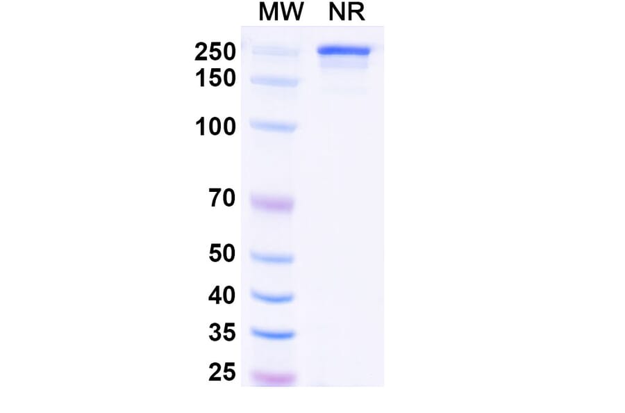 SDS-PAGE - Vipalanebart Biosimilar - Anti-PACAP Antibody - BSA and Azide free (A340626) - Antibodies.com