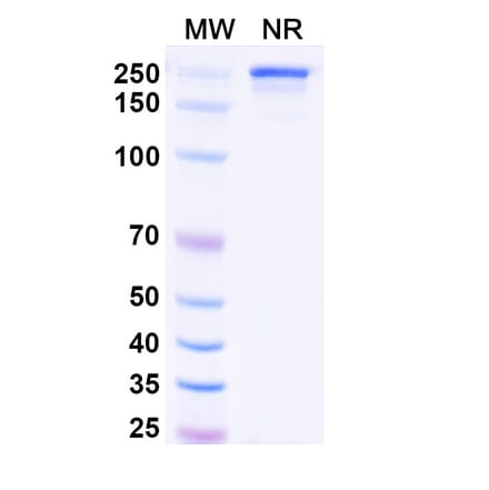 SDS-PAGE - Vipalanebart Biosimilar - Anti-PACAP Antibody - BSA and Azide free (A340626) - Antibodies.com