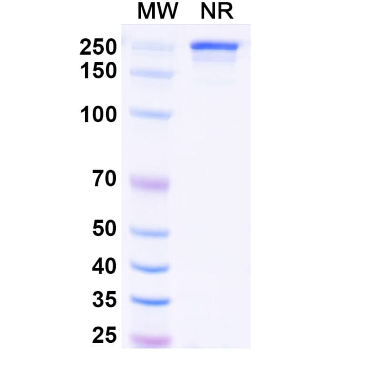 SDS-PAGE - Vipalanebart Biosimilar - Anti-PACAP Antibody - BSA and Azide free (A340626) - Antibodies.com