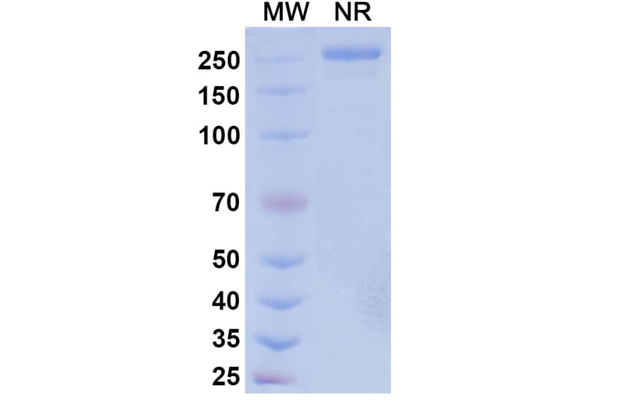 SDS-PAGE - Vipalanebart Biosimilar - Anti-PACAP Antibody - BSA and Azide free (A340626) - Antibodies.com