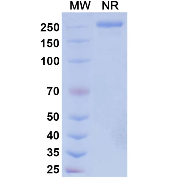 SDS-PAGE - Vipalanebart Biosimilar - Anti-PACAP Antibody - BSA and Azide free (A340626) - Antibodies.com
