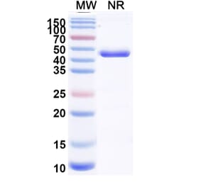 SDS-PAGE - Zeleciment Biosimilar - Anti-Transferrin Receptor Antibody - BSA and Azide free (A340628) - Antibodies.com