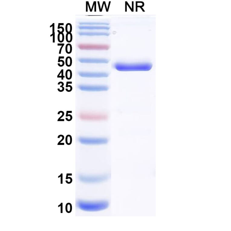 SDS-PAGE - Zeleciment Biosimilar - Anti-Transferrin Receptor Antibody - BSA and Azide free (A340628) - Antibodies.com