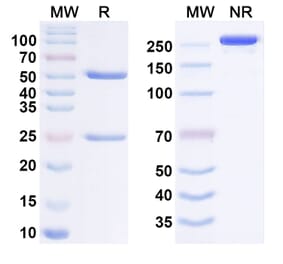 SDS-PAGE - Anti-NPR1 Antibody [REGN5381] Biosimilar - BSA and Azide free (A340642) - Antibodies.com