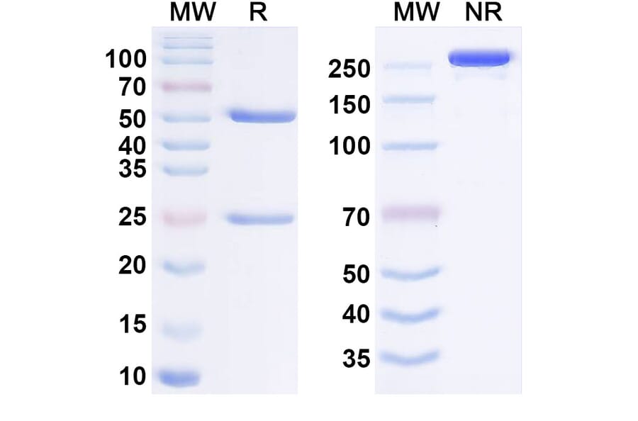 SDS-PAGE - Anti-NPR1 Antibody [REGN5381] Biosimilar - BSA and Azide free (A340642) - Antibodies.com