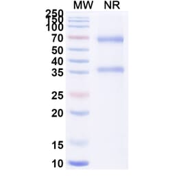 SDS-PAGE - Alteplase Biosimilar - Anti-tPA Antibody - BSA and Azide free (A340649) - Antibodies.com