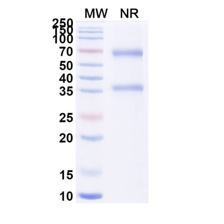 SDS-PAGE - Alteplase Biosimilar - Anti-tPA Antibody - BSA and Azide free (A340649) - Antibodies.com