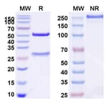 SDS-PAGE - Atrosimab Biosimilar - Anti-TNFR1 Antibody - BSA and Azide free (A340650) - Antibodies.com