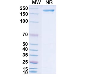SDS-PAGE - Neuradiab Biosimilar - Anti-Tenascin C Antibody - BSA and Azide free (A340660) - Antibodies.com