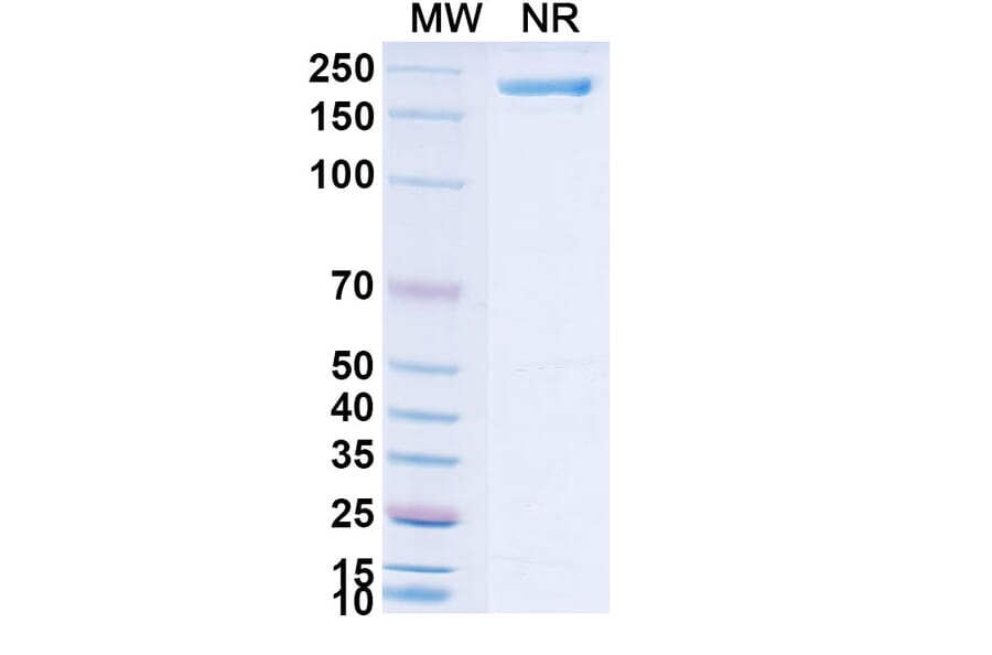SDS-PAGE - Neuradiab Biosimilar - Anti-Tenascin C Antibody - BSA and Azide free (A340660) - Antibodies.com