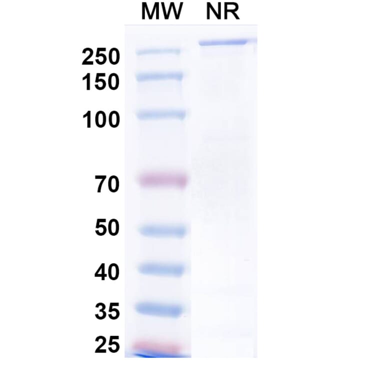 SDS-PAGE - Neuradiab Biosimilar - Anti-Tenascin C Antibody - BSA and Azide free (A340660) - Antibodies.com