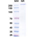 SDS-PAGE - Neuradiab Biosimilar - Anti-Tenascin C Antibody - BSA and Azide free (A340660) - Antibodies.com