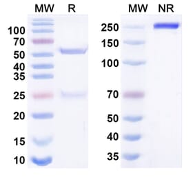 SDS-PAGE - Anti-ACVRL1 Antibody [TATX 21] Biosimilar - BSA and Azide free (A340664) - Antibodies.com