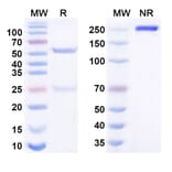 SDS-PAGE - Anti-ACVRL1 Antibody [TATX 21] Biosimilar - BSA and Azide free (A340664) - Antibodies.com