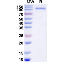 SDS-PAGE - GAA/Aglucosidase Alfa Biosimilar - Anti-GAA Antibody - BSA and Azide free (A340689) - Antibodies.com