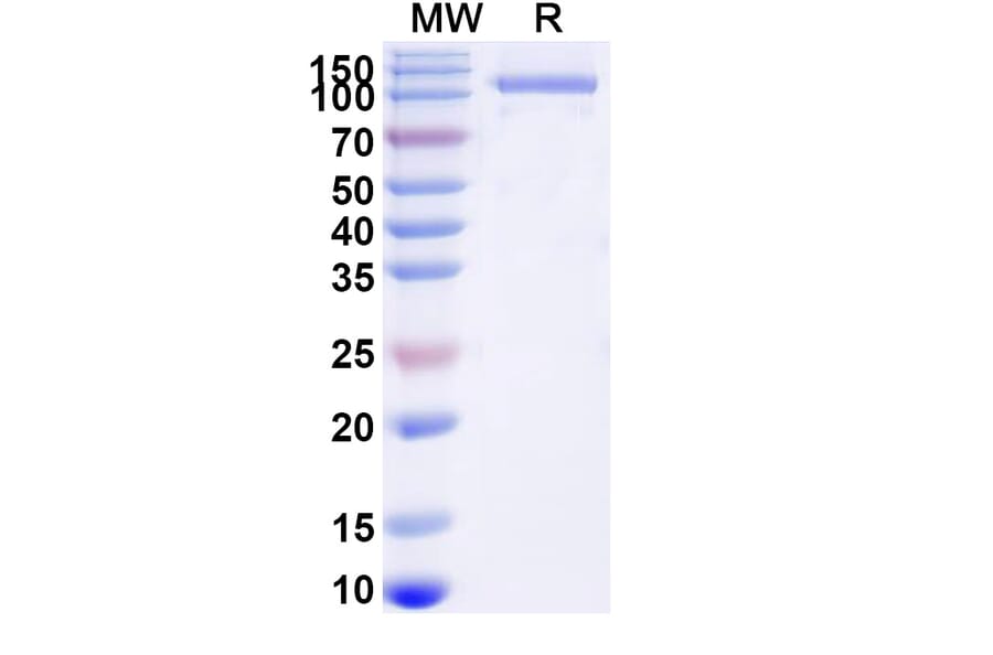 SDS-PAGE - GAA/Aglucosidase Alfa Biosimilar - Anti-GAA Antibody - BSA and Azide free (A340689) - Antibodies.com