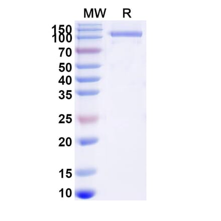 SDS-PAGE - GAA/Aglucosidase Alfa Biosimilar - Anti-GAA Antibody - BSA and Azide free (A340689) - Antibodies.com
