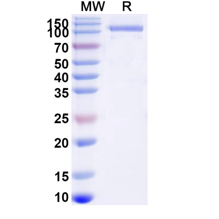 SDS-PAGE - GAA/Aglucosidase Alfa Biosimilar - Anti-GAA Antibody - BSA and Azide free (A340689) - Antibodies.com