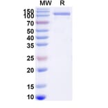SDS-PAGE - GAA/Aglucosidase Alfa Biosimilar - Anti-GAA Antibody - BSA and Azide free (A340689) - Antibodies.com