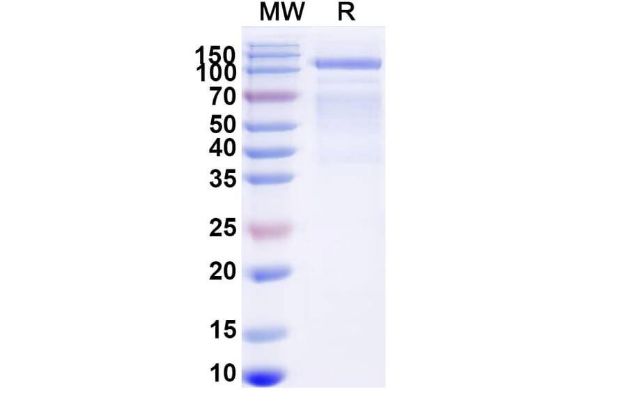 SDS-PAGE - GAA/Aglucosidase Alfa Biosimilar - Anti-GAA Antibody - BSA and Azide free (A340689) - Antibodies.com