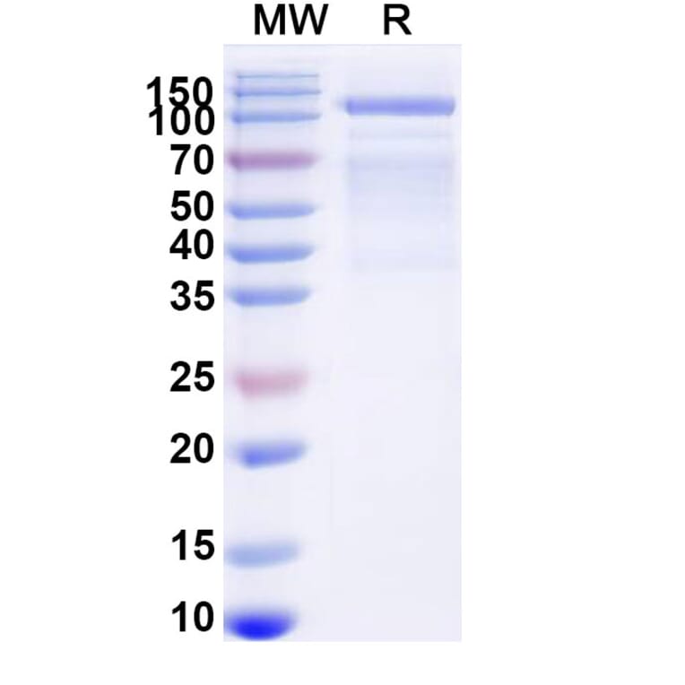 SDS-PAGE - GAA/Aglucosidase Alfa Biosimilar - Anti-GAA Antibody - BSA and Azide free (A340689) - Antibodies.com
