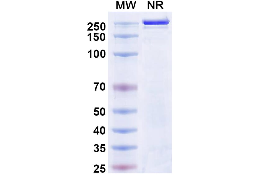 SDS-PAGE - Atigotatug Biosimilar - Anti-Fucosyl-GM1 Antibody - BSA and Azide free (A340701) - Antibodies.com