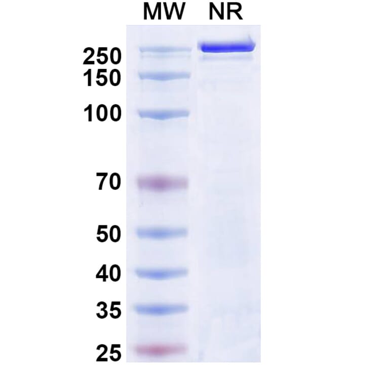 SDS-PAGE - Atigotatug Biosimilar - Anti-Fucosyl-GM1 Antibody - BSA and Azide free (A340701) - Antibodies.com