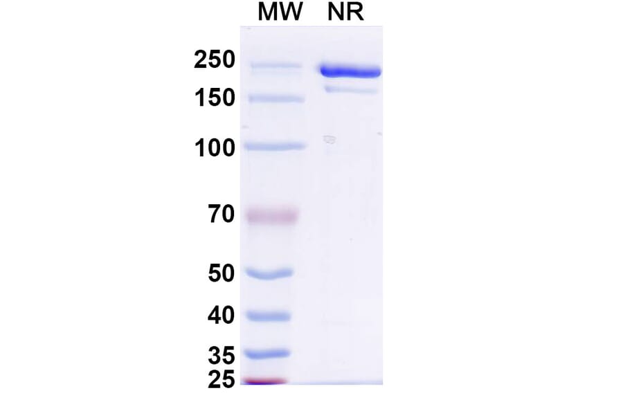 SDS-PAGE - Atigotatug Biosimilar - Anti-Fucosyl-GM1 Antibody - BSA and Azide free (A340701) - Antibodies.com