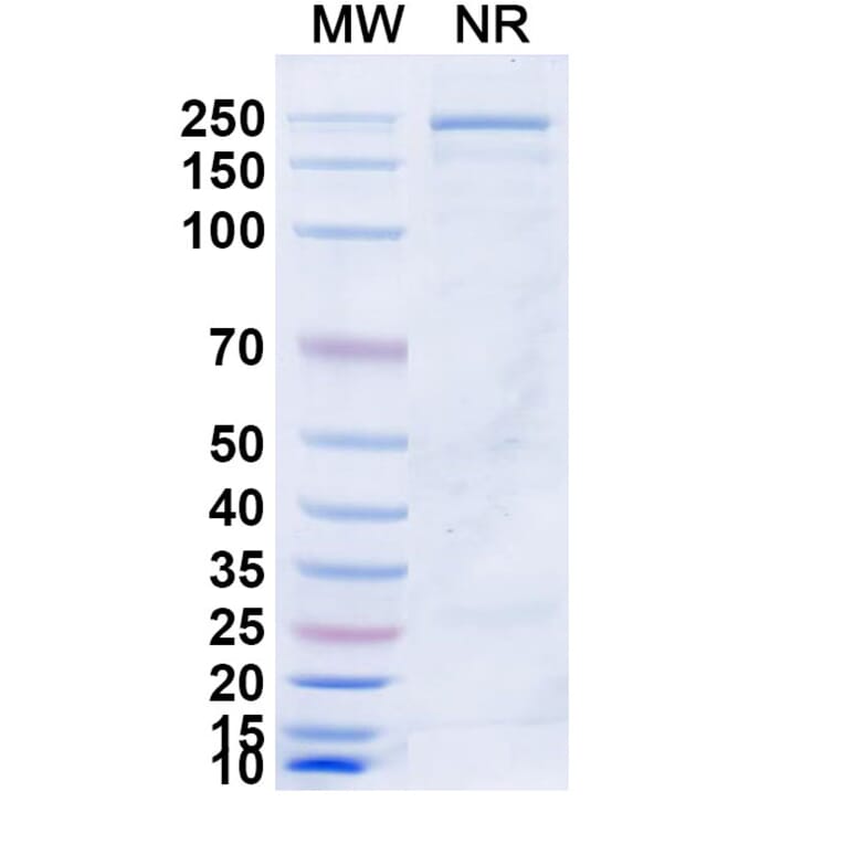 SDS-PAGE - Azirkitug Biosimilar - Anti-CCR8 Antibody - BSA and Azide free (A340703) - Antibodies.com