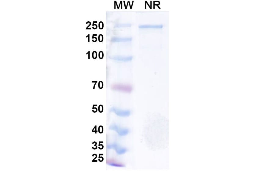 SDS-PAGE - Azirkitug Biosimilar - Anti-CCR8 Antibody - BSA and Azide free (A340703) - Antibodies.com