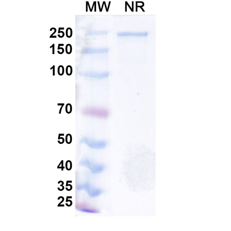 SDS-PAGE - Azirkitug Biosimilar - Anti-CCR8 Antibody - BSA and Azide free (A340703) - Antibodies.com
