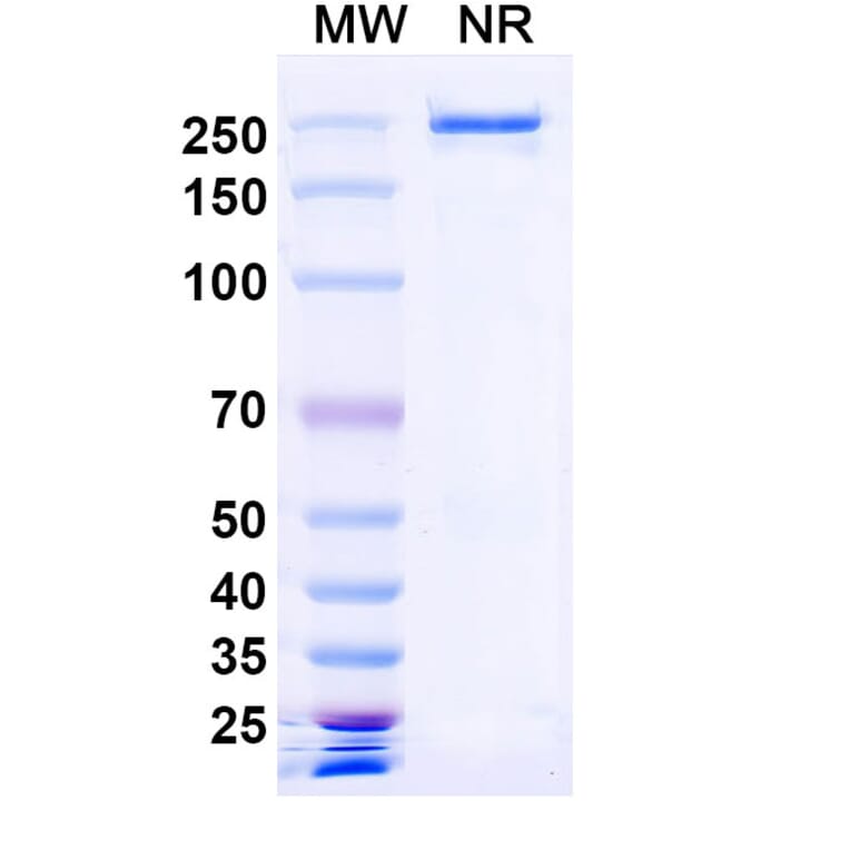 SDS-PAGE - Denikitug Biosimilar - Anti-CCR8 Antibody - BSA and Azide free (A340704) - Antibodies.com