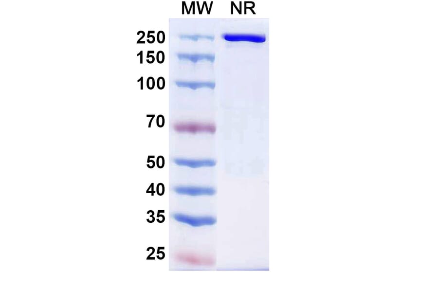 SDS-PAGE - Cafelkibart Biosimilar - Anti-CCR8 Antibody - BSA and Azide free (A340705) - Antibodies.com