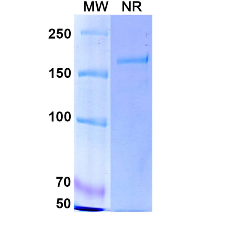 SDS-PAGE - Cafelkibart Biosimilar - Anti-CCR8 Antibody - BSA and Azide free (A340705) - Antibodies.com