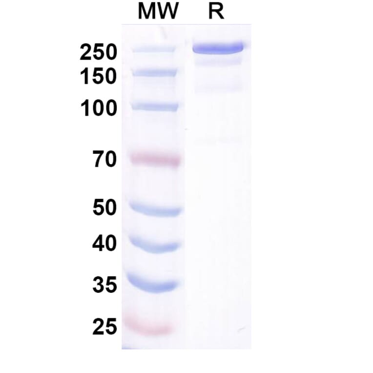 SDS-PAGE - Bosakitug Biosimilar - Anti-TSLP Antibody - BSA and Azide free (A340708) - Antibodies.com