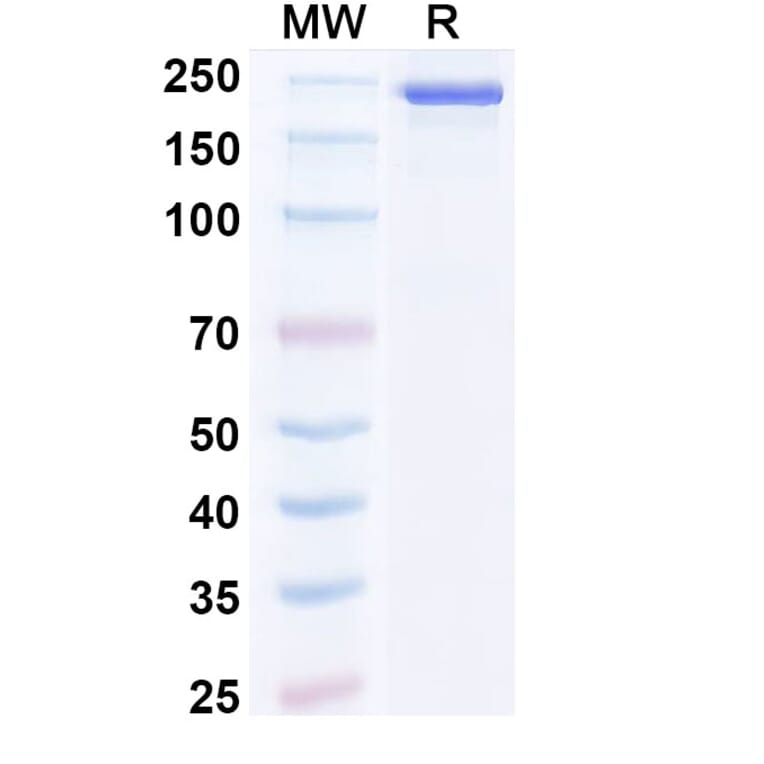SDS-PAGE - Bosakitug Biosimilar - Anti-TSLP Antibody - BSA and Azide free (A340708) - Antibodies.com