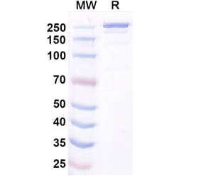 SDS-PAGE - Ocankitug Biosimilar - Anti-TSLP Antibody - BSA and Azide free (A340709) - Antibodies.com